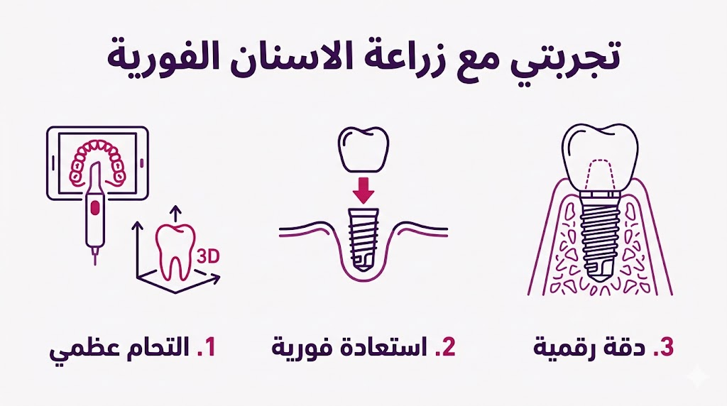 إنفوجرافيك طبي يشرح المراحل الثلاث الأساسية في تجربتي مع زراعة الاسنان الفورية.