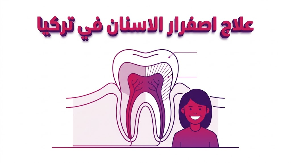  مخطط تشريحي طبي يوضح آلية عمل تقنيات علاج اصفرار الاسنان في تركيا وتأثيرها على طبقة المينا.