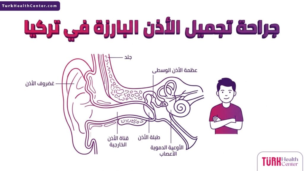 مخطط إنفوجرافيك طبي دقيق يشرح تشريح الغضروف في جراحة تجميل الأذن البارزة في تركيا.