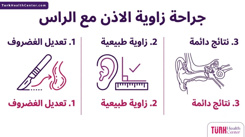 إنفوجرافيك طبي يبرز أهم 3 خطوات رئيسية والفوائد المتعلقة بإجراء جراحة زاوية الاذن مع الراس.