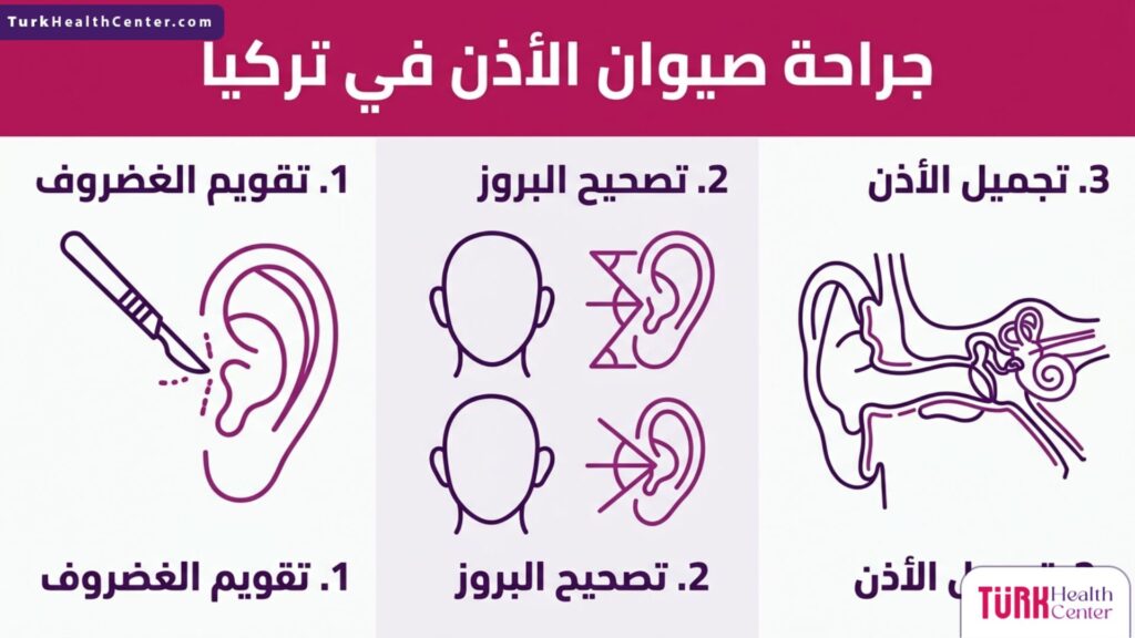 إنفوجرافيك طبي مقسم إلى ثلاث مراحل يشرح خطوات جراحة صيوان الأذن في تركيا.