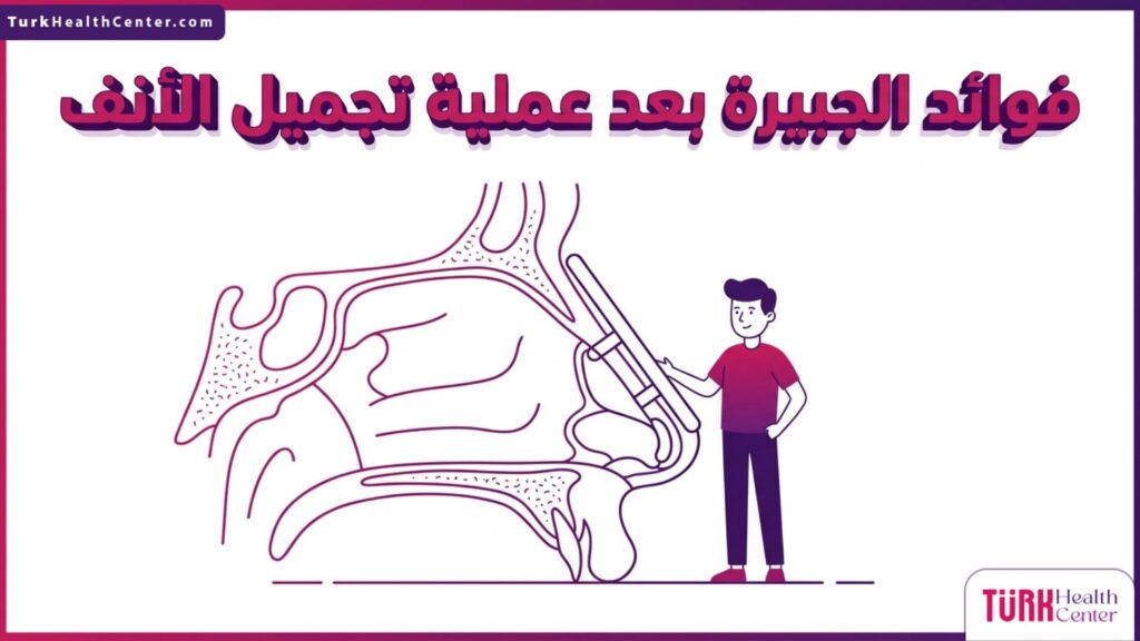 مخطط تشريحي دقيق يوضح فوائد الجبيرة بعد عملية تجميل الأنف في دعم الهيكل الداخلي