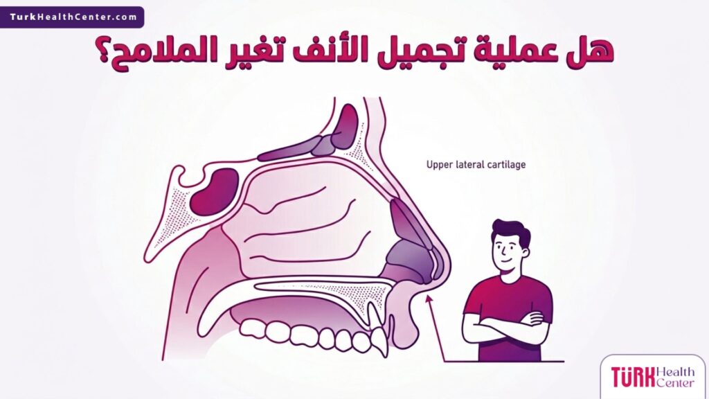رسم تشريحي يوضح هل عملية تجميل الأنف تغير الملامح؟ وكيفية تعديل الهيكل الغضروفي للأنف.