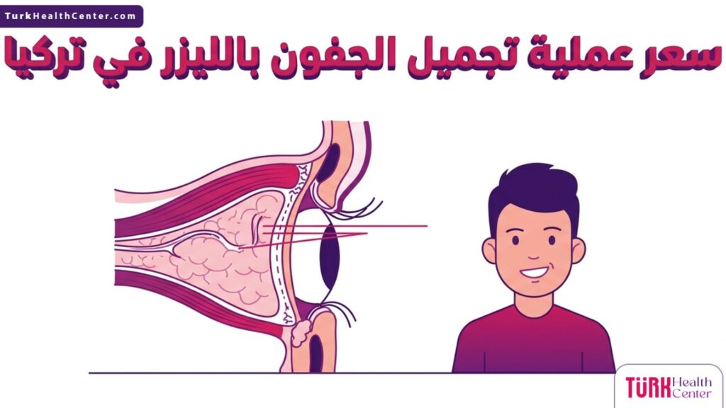 إنفوجرافيك طبي تشريحي يوضح تشريح الجفن والأنسجة لبيان سعر عملية تجميل الجفون بالليزر في تركيا.