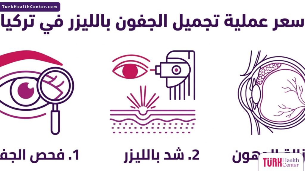إنفوجرافيك ثلاثي الأقسام يوضح المراحل والعوامل التي تحدد سعر عملية تجميل الجفون بالليزر في تركيا.