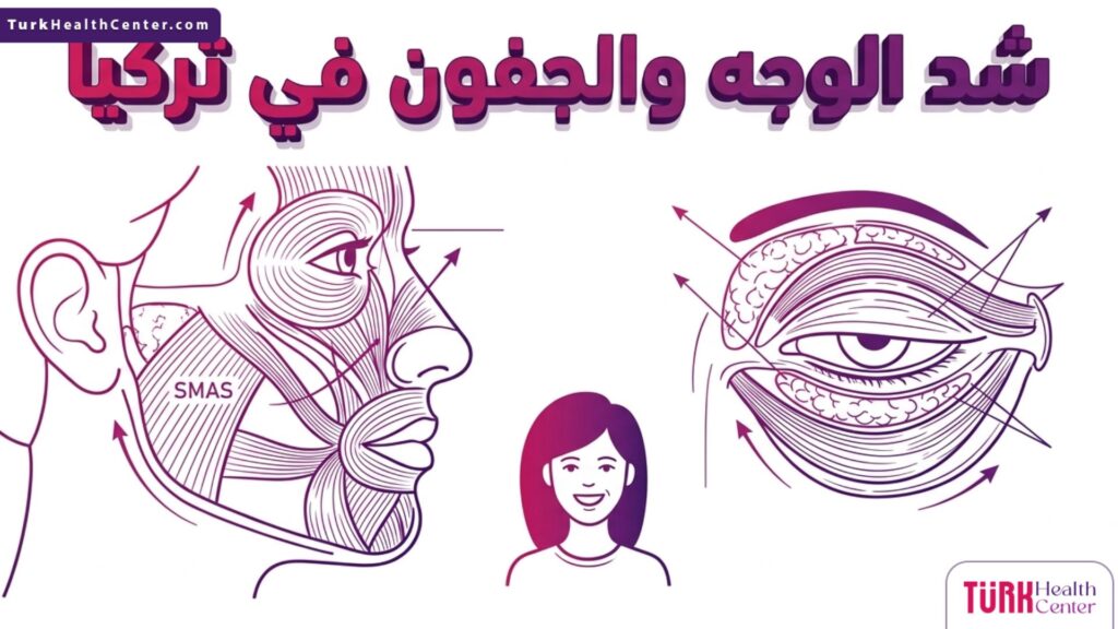 تصميم إنفوجرافيك تشريحي يوضح التقنية الطبية لعملية شد الوجه والجفون في تركيا