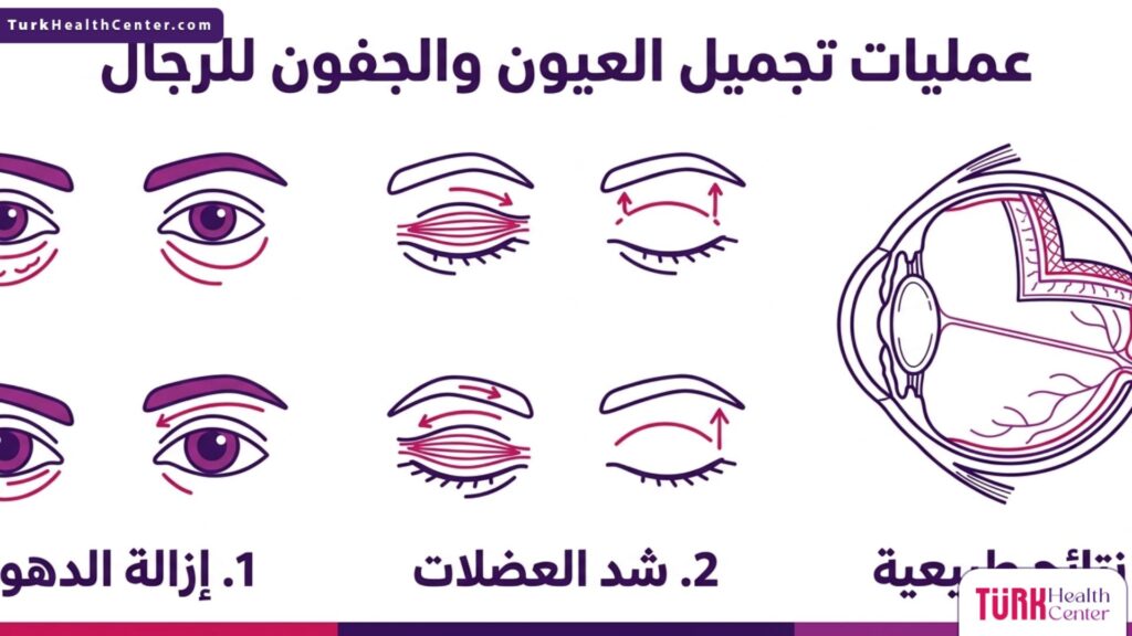 إنفوجرافيك يوضح خطوات وفوائد عمليات تجميل العيون والجفون للرجال.
