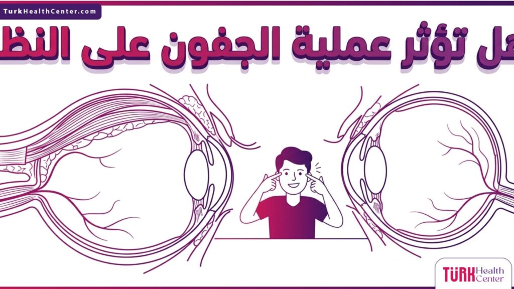 إنفوجرافيك تشريحي دقيق للعين يوضح بالرسم العلمي هل تؤثر عملية الجفون على النظر ويوضح سلامة تركيبة العين الداخلية.