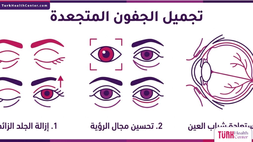 إنفوجرافيك طبي متخصص يبرز ثلاث فوائد رئيسية لعملية تجميل الجفون المتجعدة.