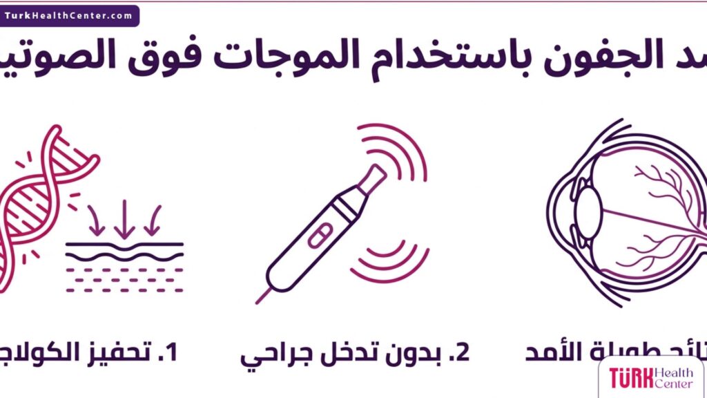 مخطط هندسي إنفوجرافيك يوضح المزايا الثلاث الرئيسية لعملية شد الجفون باستخدام الموجات فوق الصوتية بشكل أيقونات طبية متطورة.