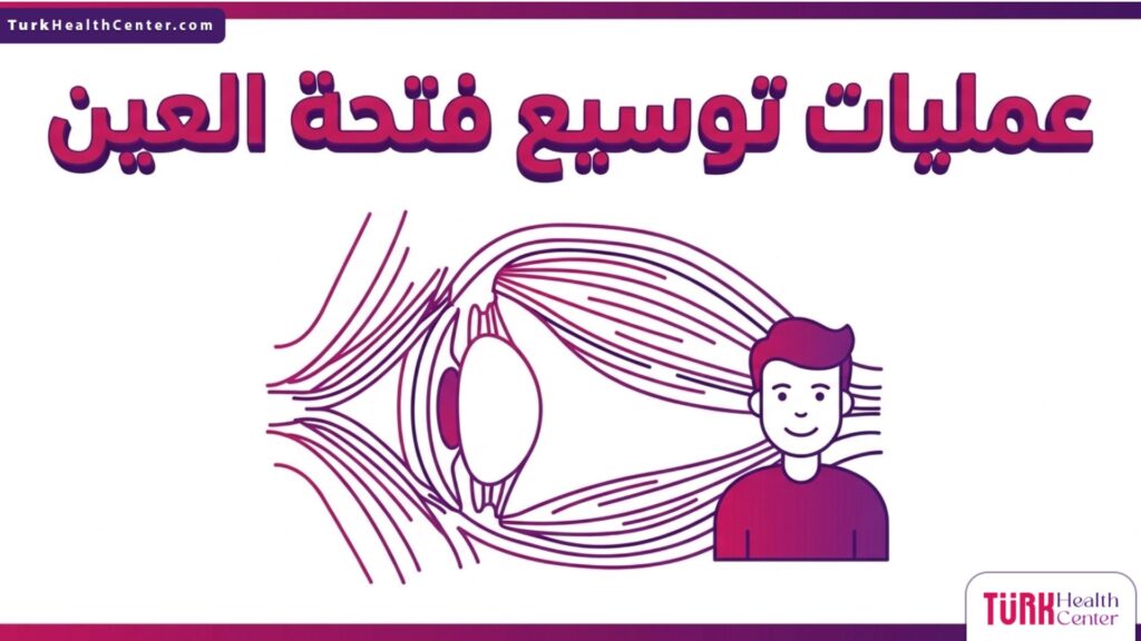 مخطط تشريحي دقيق يوضح العضلات والأربطة المستهدفة في عمليات توسيع فتحة العين.
